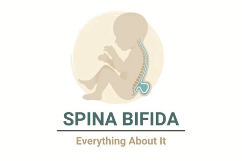 Spina Bifida: Causes, Symptoms, Diagnoses, and Treatment